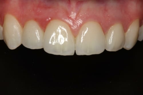 mucoderm