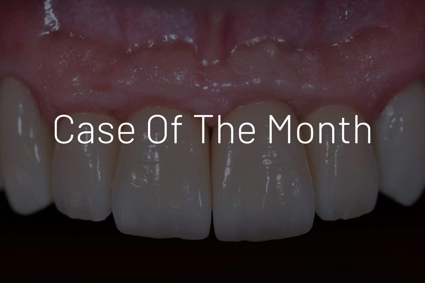 Case of the month