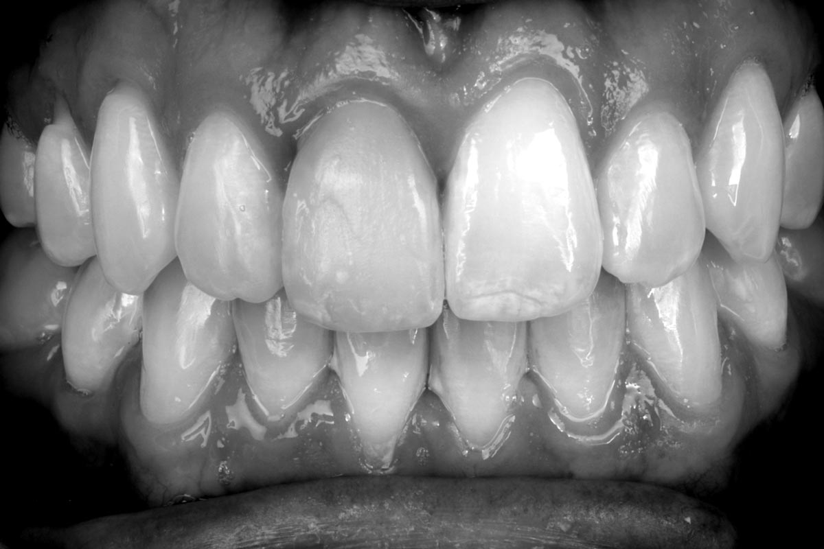 Case by Dr. Sheylla Brito