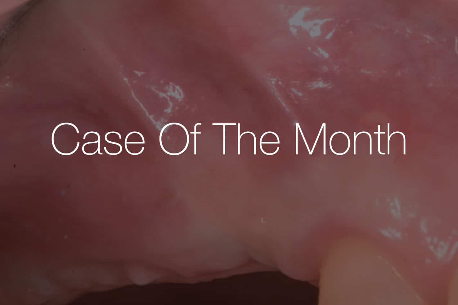 Close-up view of a soft tissue surface with a glossy appearance, labeled as 'Case Of The Month'.