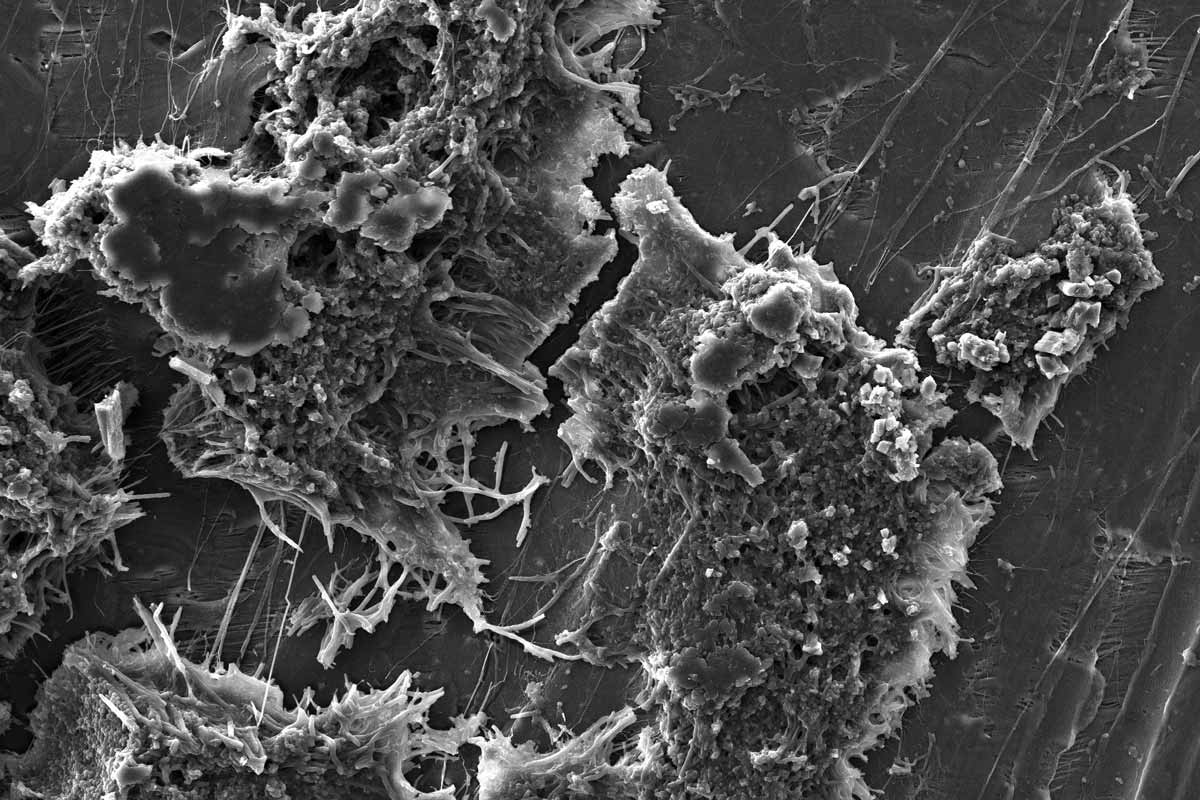 Permamem study campus image reveals intricate dental biomaterial microstructure with fibrous networks and granular clusters captured under magnified electron microscopy.