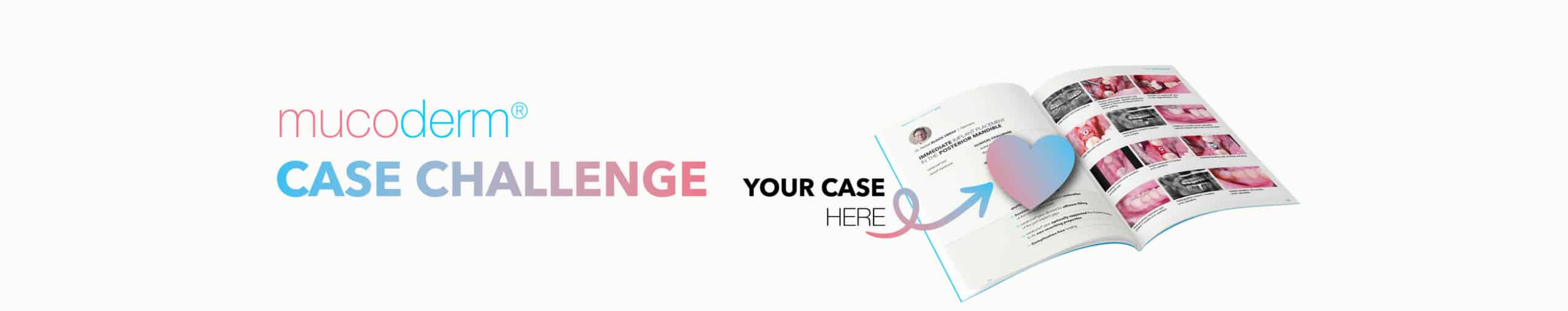 mucoderm® Case Challenge with “Your case here” text, pink-blue typography over an open case book and a heart icon graphic