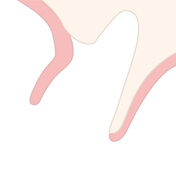 Curved dental socket illustration with pink buccal bone outline and green tissue area, showing buccal bone without tooth for socket management.