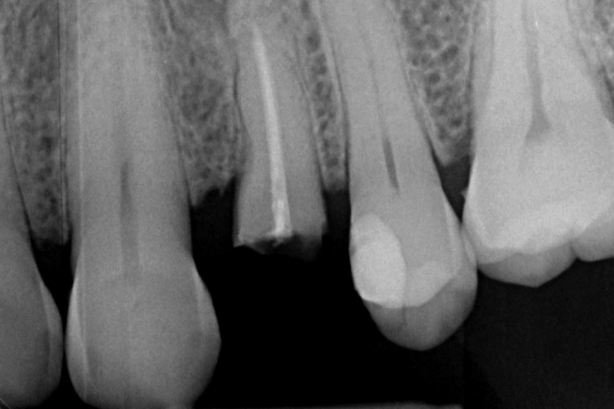 2-Initial-radiographic-situation_Sigmar_Schnuttenhaus Initial radiographic situation