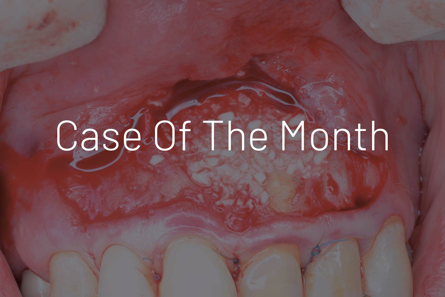 Case of the month