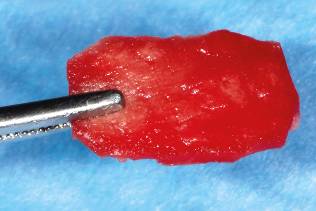 4-CASE_Piero_Papi_2026_4 mucoderm® after hydration in blood.