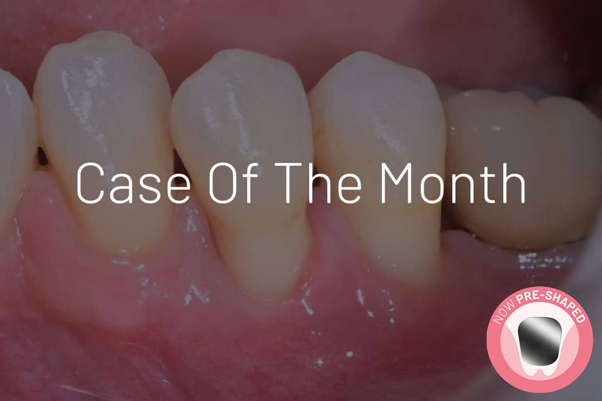 Case of the month